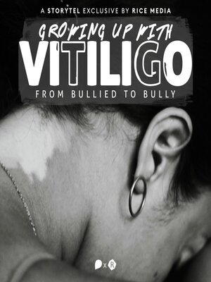 cover image of Growing Up With Vitiligo, I Was Bullied—Until I Became a Bully